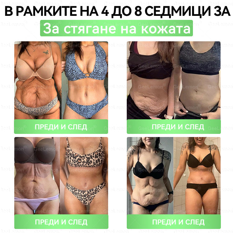 🌟Официален магазин 👩‍⚕️ 𝐆𝐞𝐞𝐥𝐞𝐦𝐨𝐧® 𝐆𝐥𝐮𝐦𝐚𝐬𝐞𝐭𝐢𝐝𝐞 𝟖 в 𝟏 – Нано микроиглен пластир за отслабване | Само 1× дневно ✅ Видими промени за 7 дни – при затлъстяване, сърдечно-съдово здраве, диабет и ставни проблеми🌟🌟🌟🎄