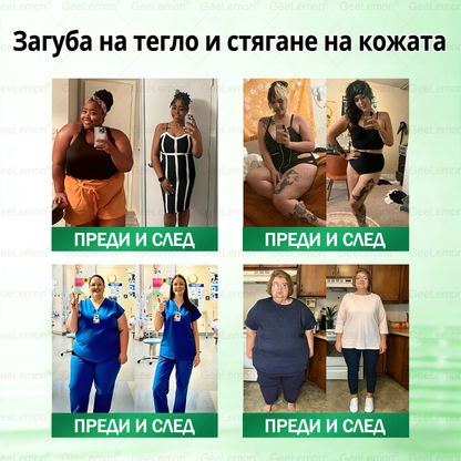🌟Официален магазин 👩‍⚕️ 𝐆𝐞𝐞𝐥𝐞𝐦𝐨𝐧® 𝐆𝐥𝐮𝐦𝐚𝐬𝐞𝐭𝐢𝐝𝐞 𝟖 в 𝟏 – Нано микроиглен пластир за отслабване | Само 1× дневно ✅ Видими промени за 7 дни – при затлъстяване, сърдечно-съдово здраве, диабет и ставни проблеми🌟🌟🌟🎄