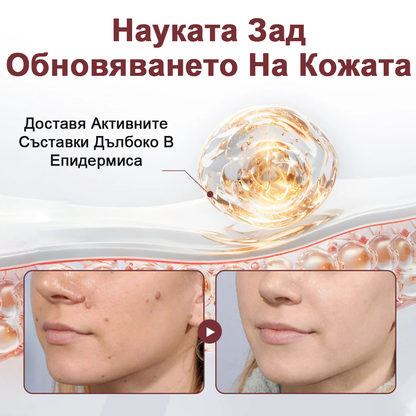 🏆Pureluxo® KeraErase Двукомпонентен обновяващ крем с двойно действие🏆🍀🍀