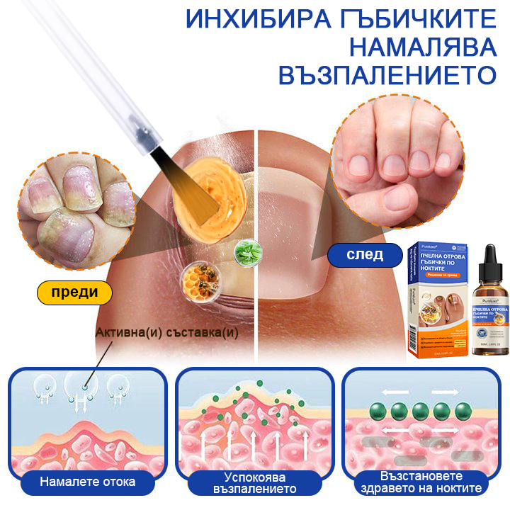 Pureluxo® 🚚Лечение на гъбички по ноктите с пчелна отрова: Пълно решение на проблема с гъбичките по ноктите 🐝🐝🐝